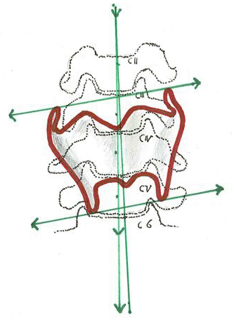 Fig. 4 dossier Alterazioni Cervicali prodotto dalla dottoressa Maria Elena Berioli